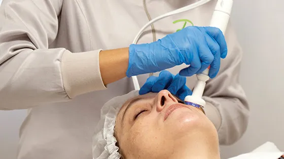 Revitalização com Jato de Plasma