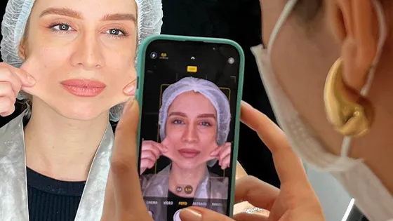 Rejuvenate Naturally with Collagen Biostimulator